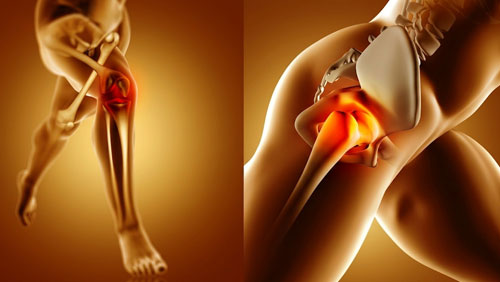 Knee & Hip Replacement Surgery