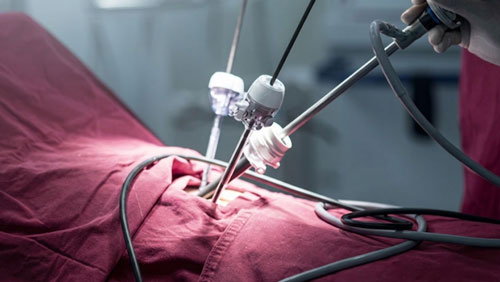 Spine Surgery