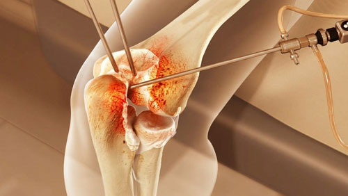 Sports Injury Treatment