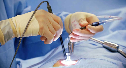Minimally Invasive Spine Surgery